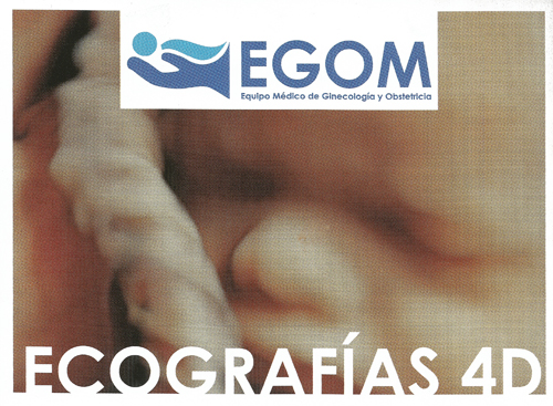 Ecografías 4D: un recuerdo inolvidable de tu embarazo gracias a EGOM